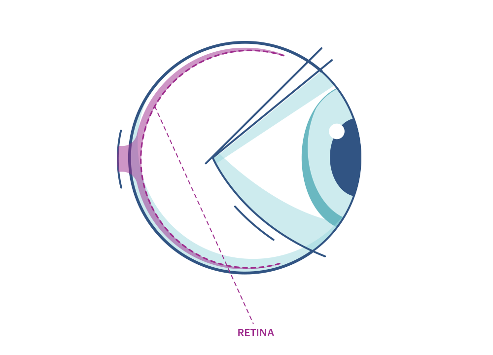 Illustration av ett öga som markerar näthinnan